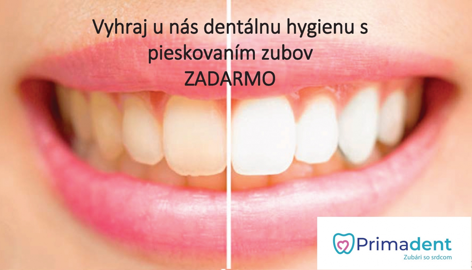 pieskovanie_fb.jpg